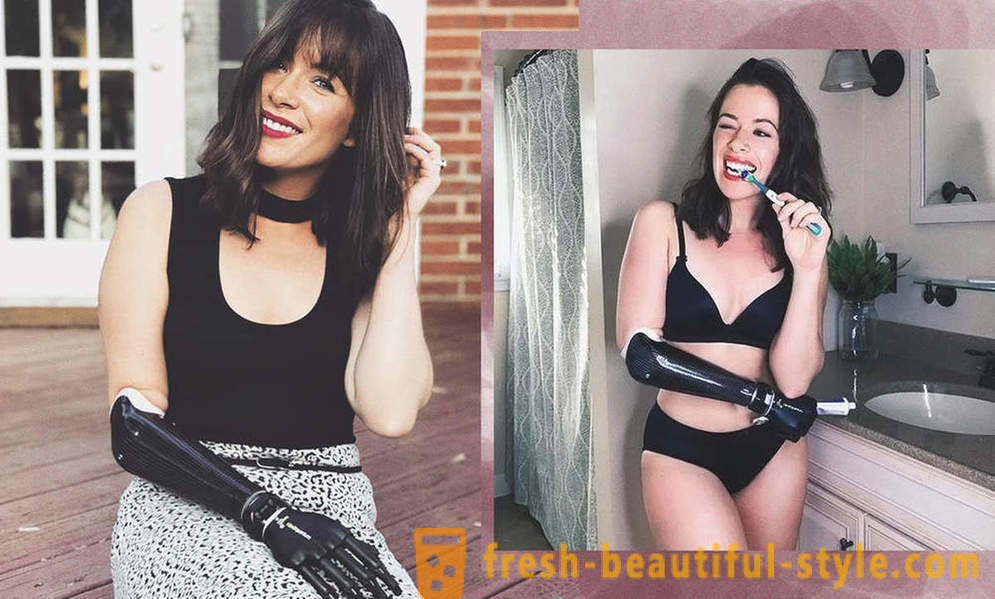 Oändlig skönhet: 6 kvinnliga modeller med proteser
