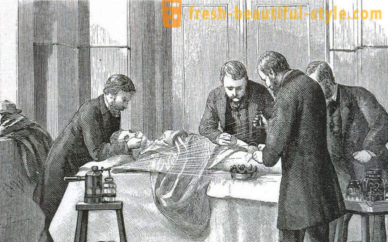 Chockerande fakta om den viktorianska kirurgi