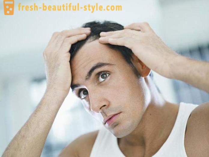 Läkemedel med minoxidil för hår: omdömen, funktioner och beskrivning av tillämpningen av bästa