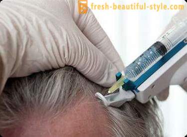 Mesotherapy för hår: smink verktyg och kontra