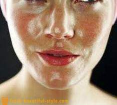 Fet hud ansikte: vad man ska göra för att ta itu med problemet?